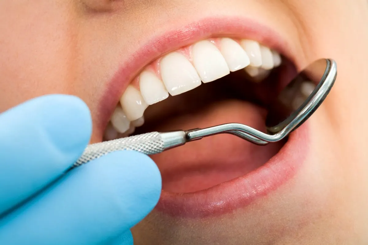 Keçiören Diş Polikliniğinde Estetik Diş Tedavisi Fiyatları